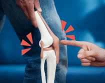 タナ障害（膝滑膜ひだ障害）の原因