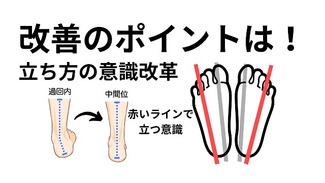 子供の足、大丈夫？回内足・偏平足を改善する簡単整体法！自宅できるよ