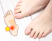 足底筋膜炎は硬い床で裸足は注意